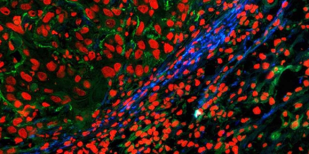 Researchers make tumors visible